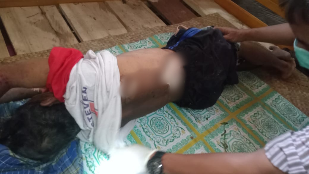 Seorang Pria Ditemukan Tak Bernyawa, Keluarga Korban Tolak Lakukan Otopsi