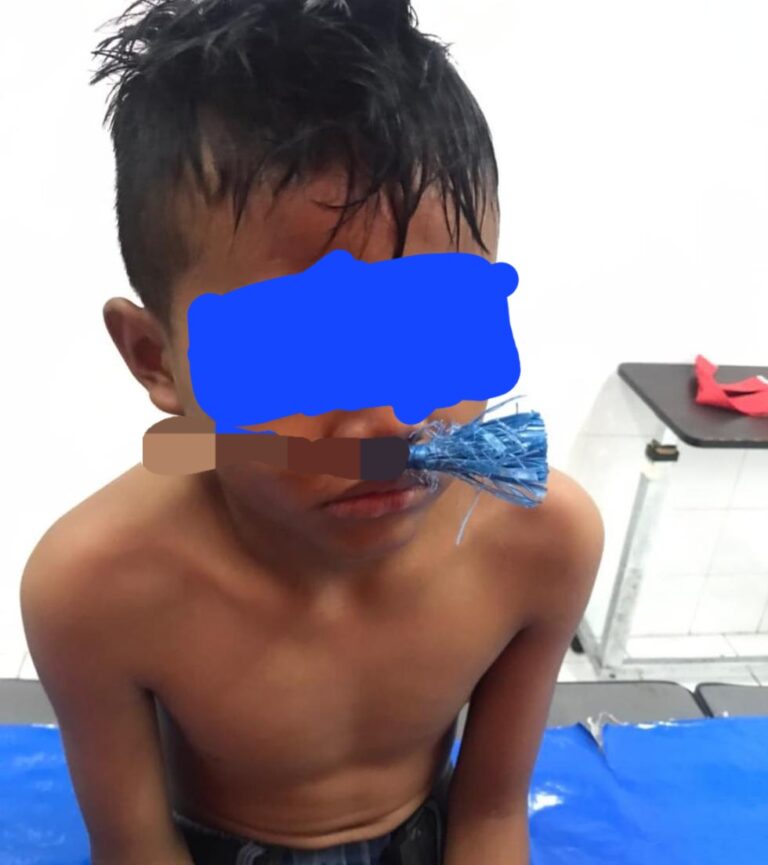 Tawuran di Makassar, Seorang Bocah Terkenah Anak Panah