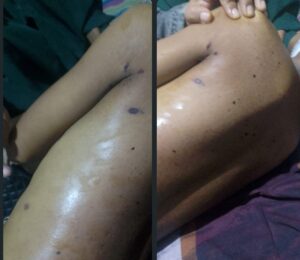 Siswa SD Maccini 1 Tewas Di duga di Aniaya Siswa SD Maccini 1 Tewas Di duga di Aniaya