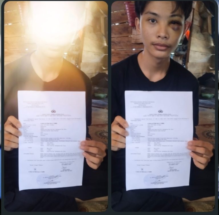 Remaja Lebam di Bone, Dugaan Penganiayaan Anak Disorot Keras, Polisi Diminta Bertindak Tegas